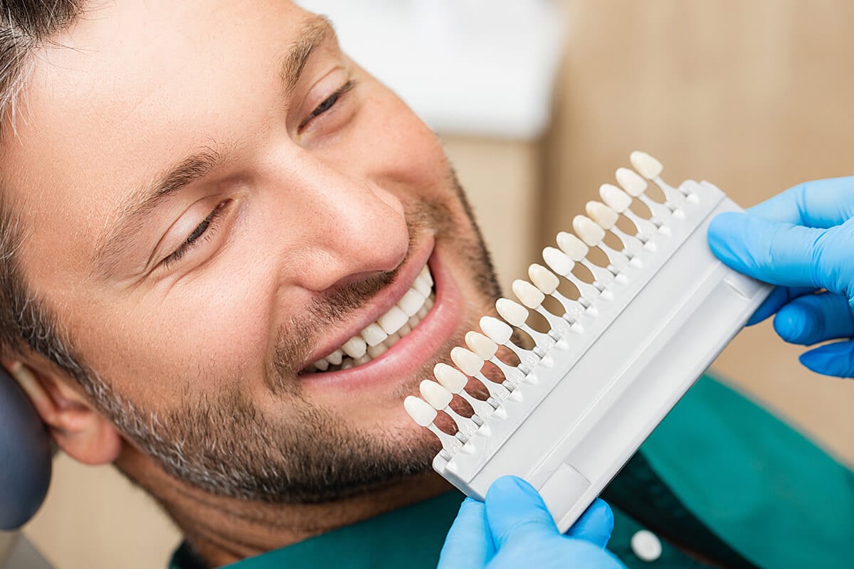 How Long Do Porcelain Veneers Last? Oakdale Dental
