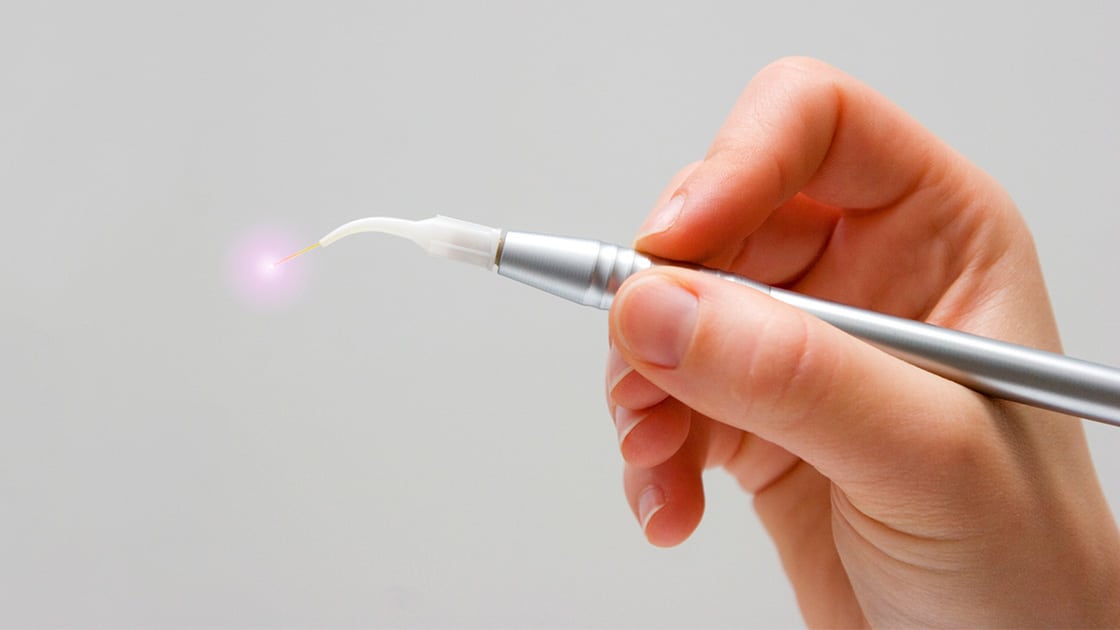 Lasers in Dentistry